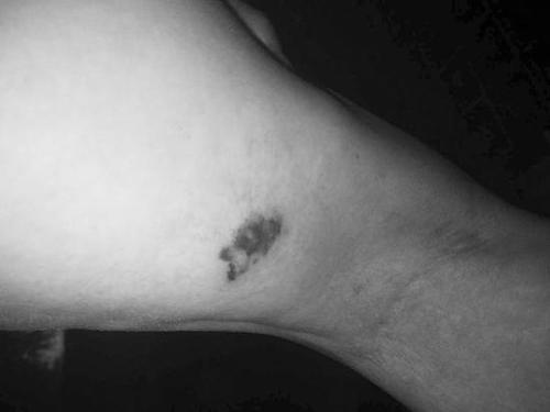 七旬老太小区遛弯时被狗咬伤 狗主人见状抱狗就溜