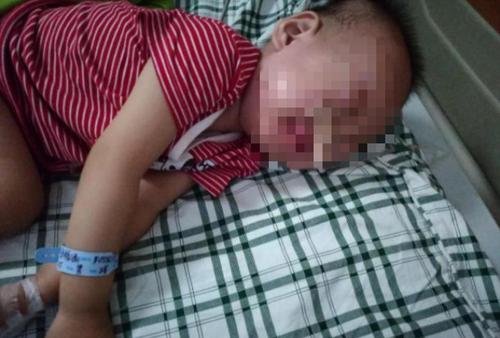 2岁男童误吞电池近20天却当胃病医 取出已严重腐蚀