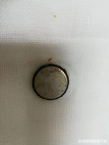 2岁男童误吞电池近20天却当胃病医 取出已严重腐蚀