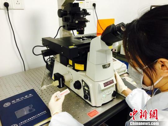 2毫升孕妇外周血即可查遗传异常专家研发无创技术