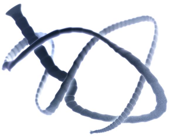 “菊花”里爬出绦虫 究竟是怎么回事?