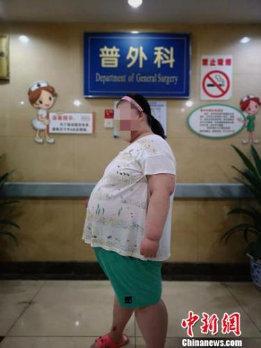 成都市第三人民医院接诊的肥胖儿童?!≈有?摄 点击进入下一页