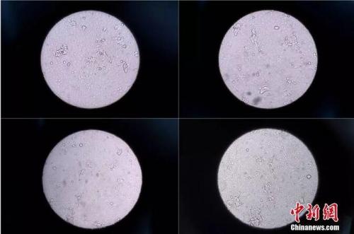 资料图 图文无关 韦亮 摄 点击进入下一页