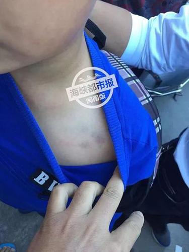 12岁学生被托管班老板打成脑震荡 警方已受案