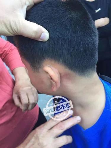 12岁学生被托管班老板打成脑震荡 警方已受案