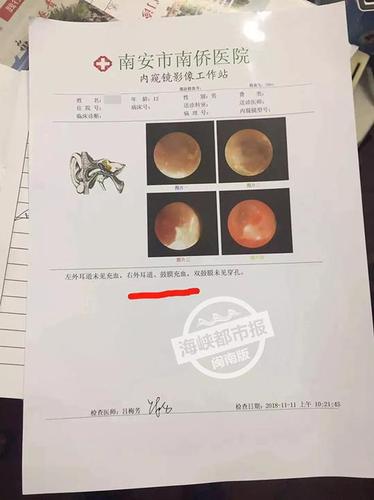 12岁学生被托管班老板打成脑震荡 警方已受案