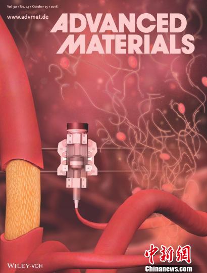 国际生物材料知名杂志封面。医院供图