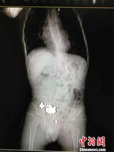 点击进入下一页