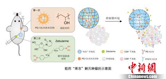 中美学者联合研发出新型抗癌制剂载药“果冻”剿灭肿瘤