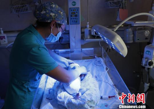 医护人员对黄疸患儿进行护理。　杨迪 摄