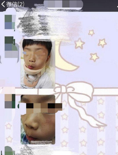 201604200045404e239 201604200045404e239