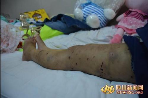 十岁女童遭养母虐待 用钳子夹舌头2