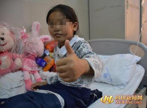 十岁女童遭养母虐待 用钳子夹舌头5