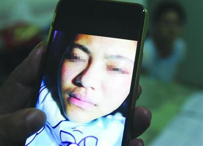 鲍嘉的父母提供的照片显示，鲍嘉的腿部、面部出现淤青红肿。/晨报记者