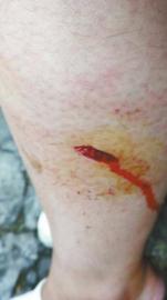 女游客回应被猴子咬伤未得景区救助:不属实